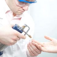 فریز کردن زگیل تناسلی