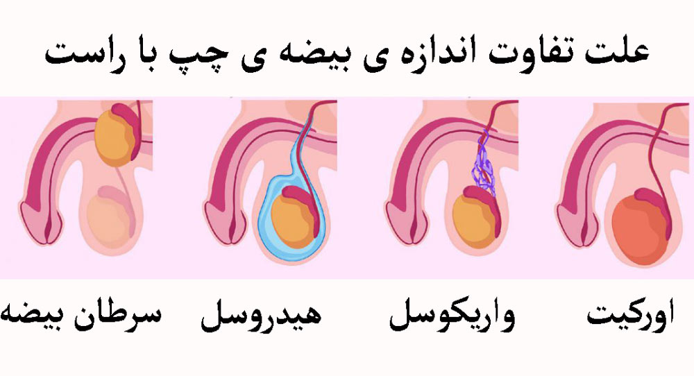 عکس بیضه سالم و ناسالم